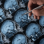 Imagen de escanografías del cerebro humano siendo analizadas por una persona.